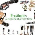 prosthesis and Orthopaedic technology