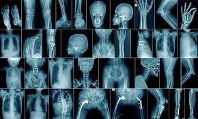 radiography